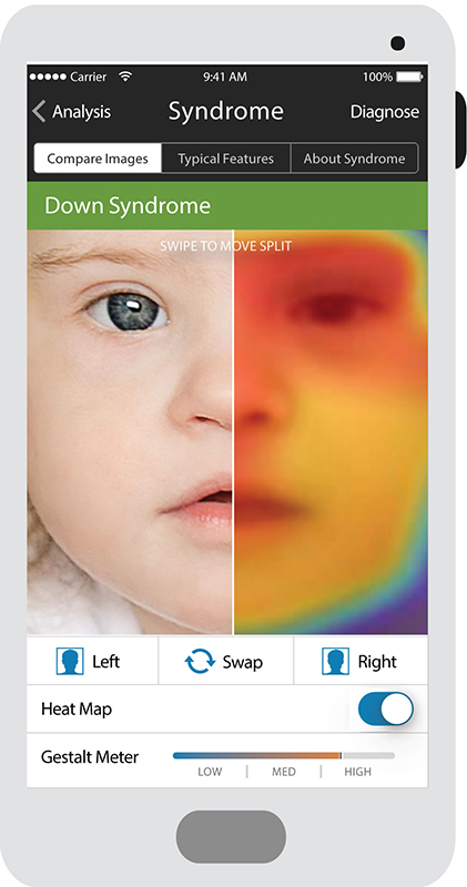 Face2Gene-Composite-Analysis.jpg