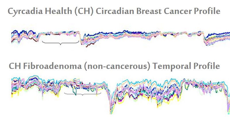 CH-Breast-Cancer-Profiles.jpg