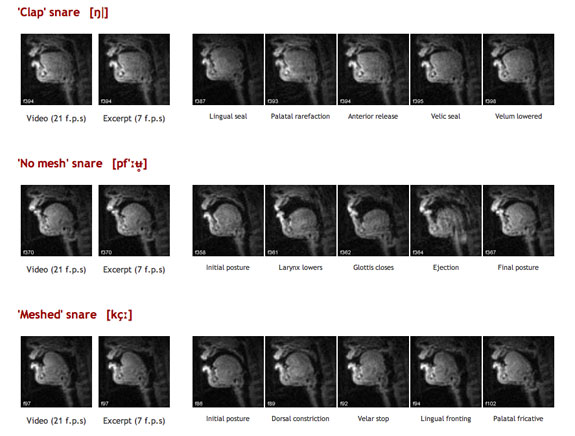 A beatboxer demonstrated three different snare drum effects while lying on an MRI scanner.