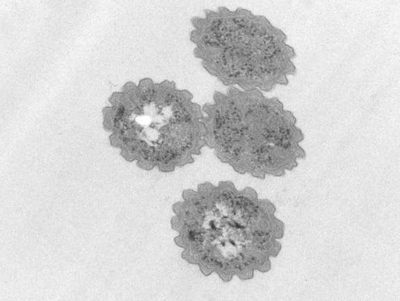 bacteria