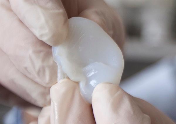 A collagen ear