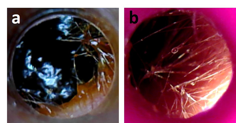 earwax_fig2.jpg