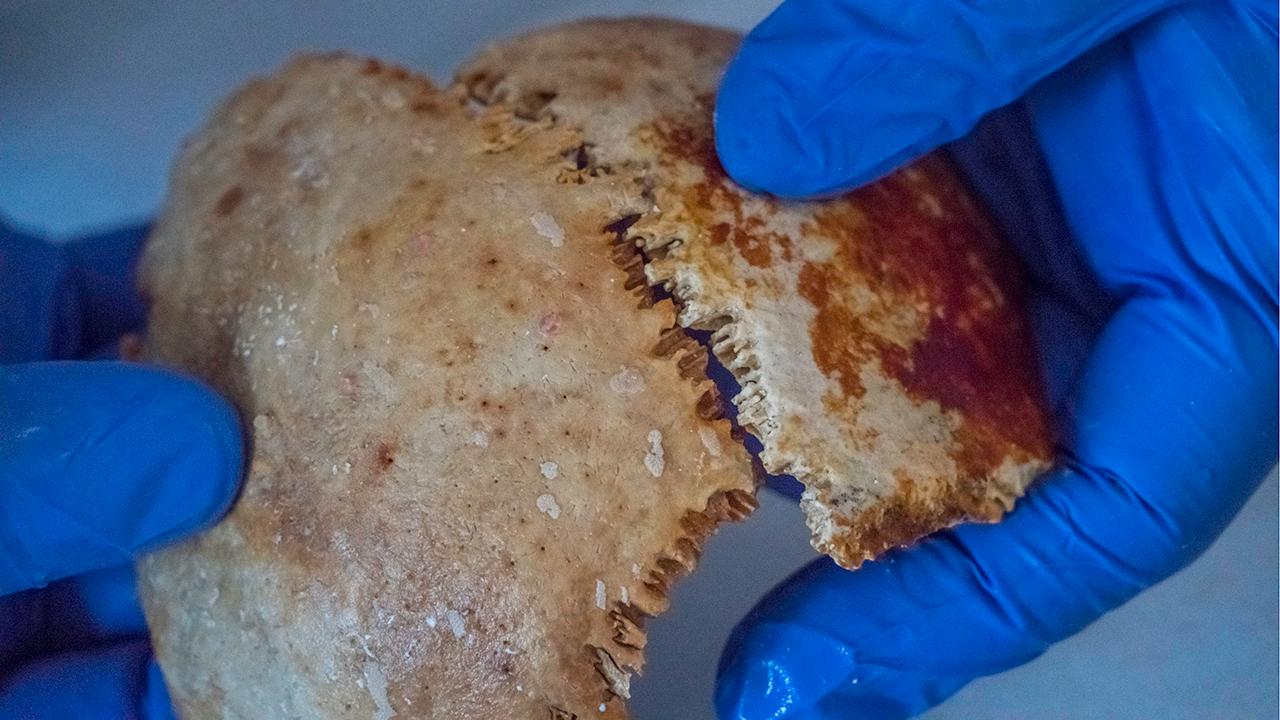 skull