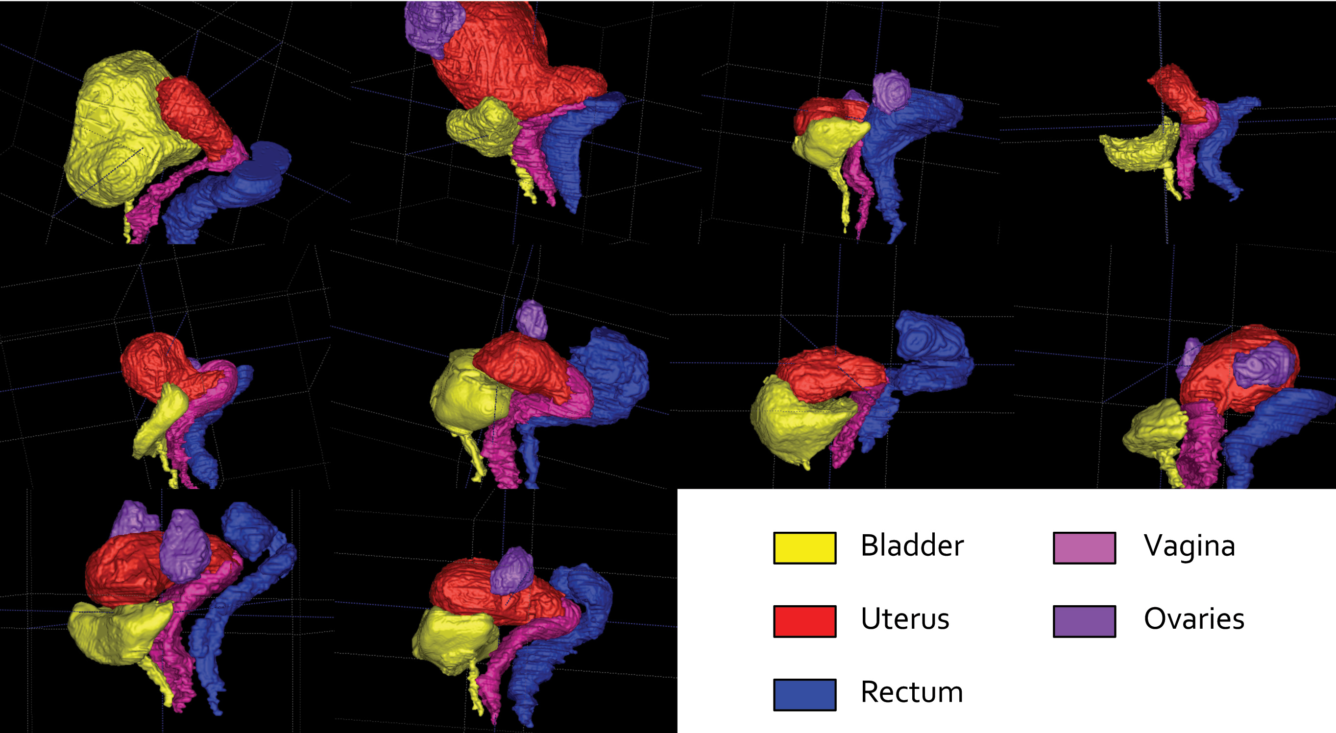 FemalePelvicAnatomicalVariability-WR.jpg
