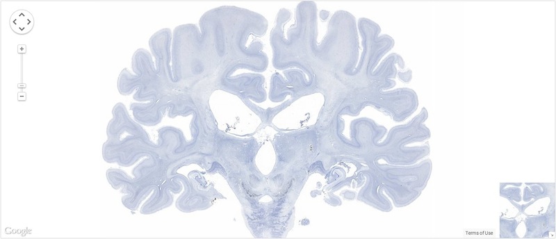 brain atlas.jpg